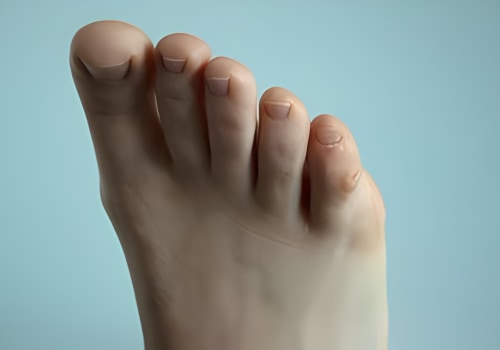Shoes, Nerves, or Injury? Causes of Claw Toe Deformity Revealed